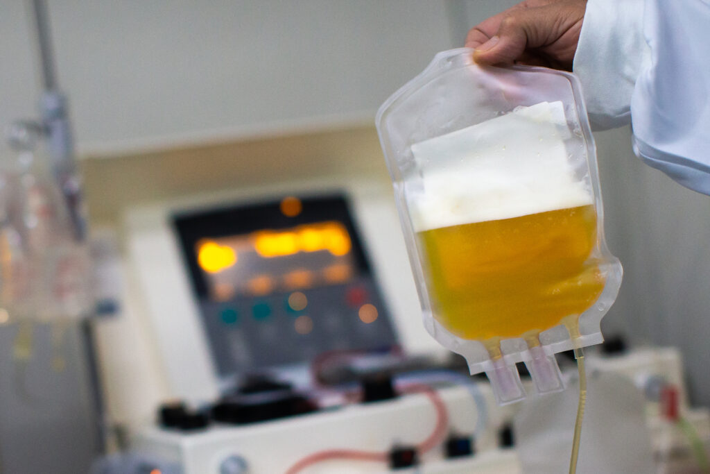 Sárgás színű vérplazma adomány zacskóban, háttérben plazmaferezis gép